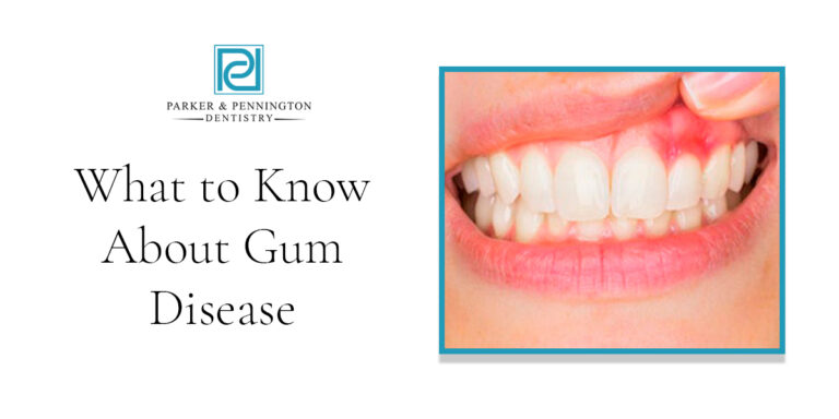 PP Jacksonville – Blog -What to know about gum disease- 1200×630 – V1
