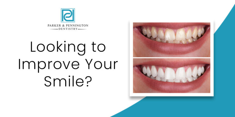 PP Jacksonville – Email – looking to improve your smile – 1200×630 – V1
