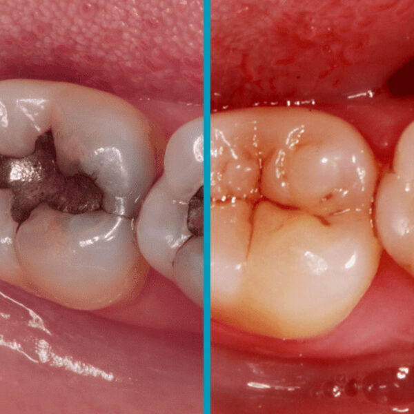 Cosmetic-Restorative-1