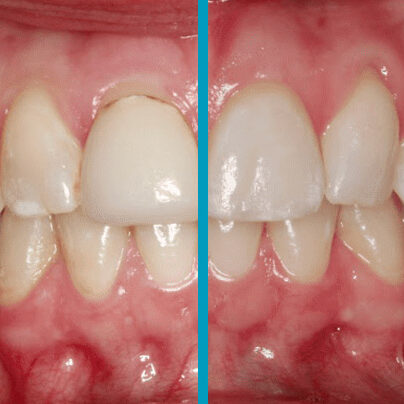 Cosmetic-Restorative-2