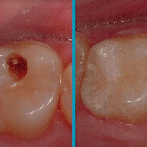 Cosmetic-Restorative-3