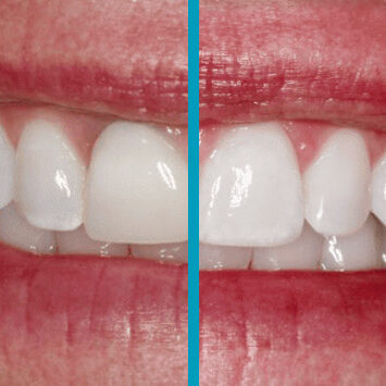 Cosmetic-Restorative-4