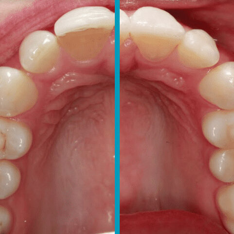 Cosmetic-Restorative-5